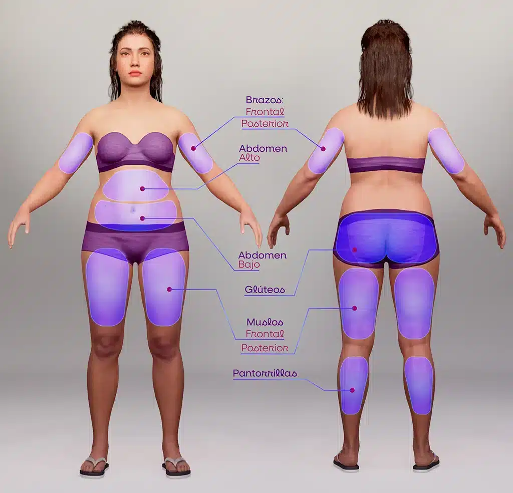 zonas tratamientos body sculpt
