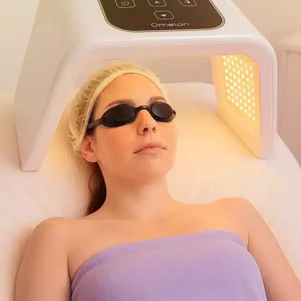 limpieza facial en estética hidalgo